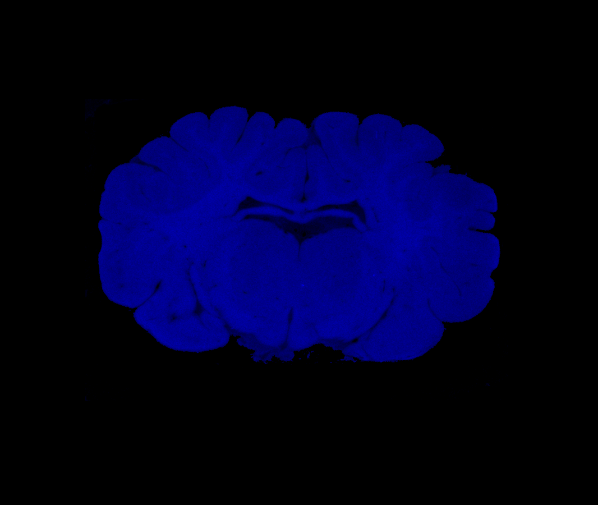 Block Face Imaging